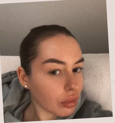 Emily Nicolls, therapist at Precious Moments Beauty Clinic in Banstead