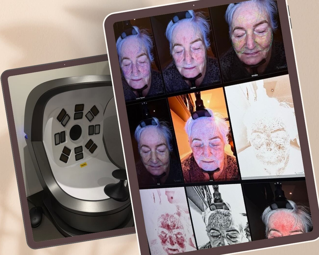 3D skin scanning analysis results on a tablet beside the skin scanner at Precious Moments Beauty Clinic, Banstead