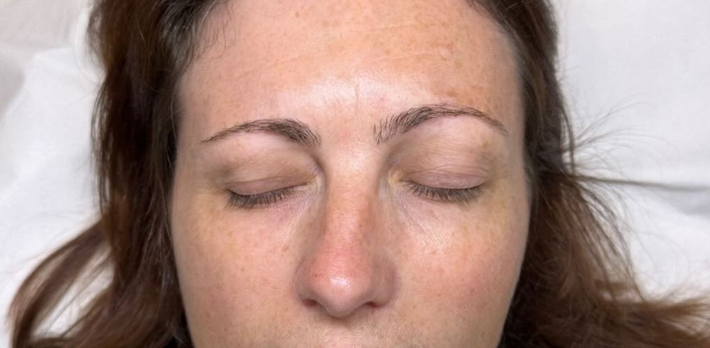 Client's sparse natural brows before microblading and ombre brow treatment at Precious Moments Beauty Clinic, Banstead