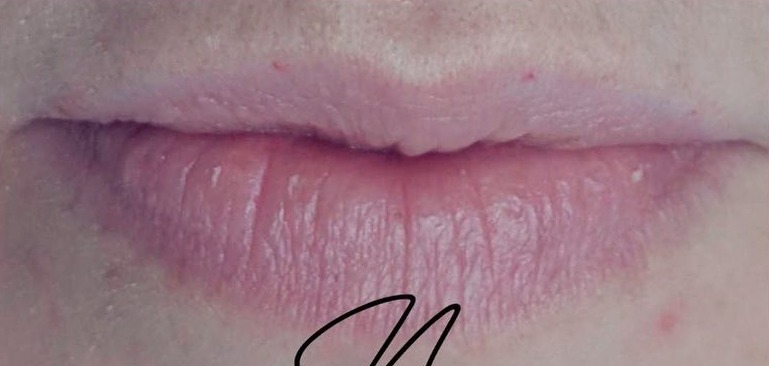 Pale, uneven natural lip colour before lip blush semi-permanent make-up in Banstead