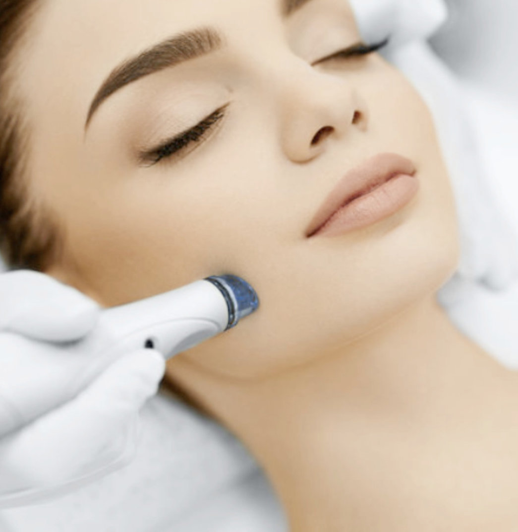 Microdermabrasion Microdermabrasion